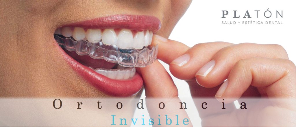 invisalign.005 001 - Ortodoncia invisible: sonríe sin complejos