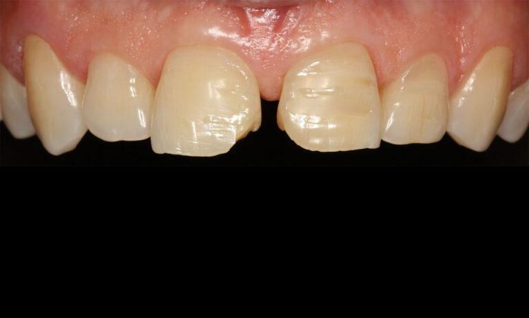 Carillas-Caso-Clinico-30