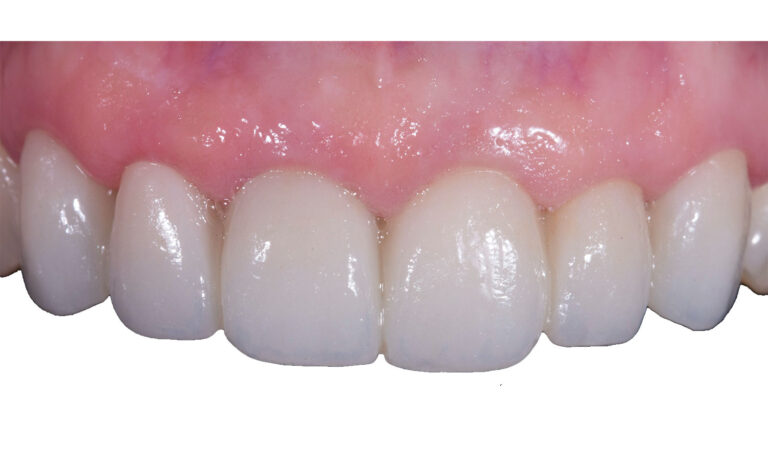 Carillas-Caso-Clinico-35