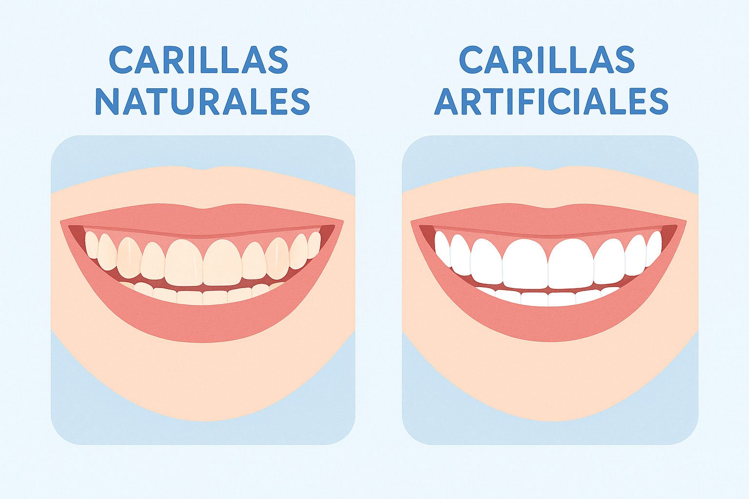 Diferencia entre carillas naturales y artificiales