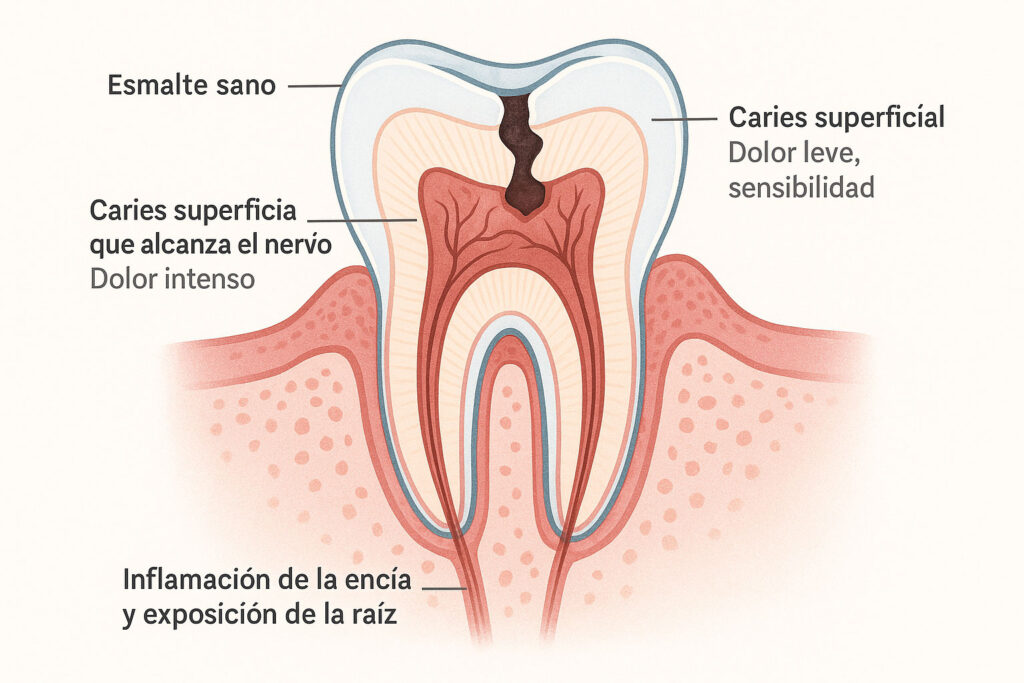 Schematic diagram of mild or severe toothache