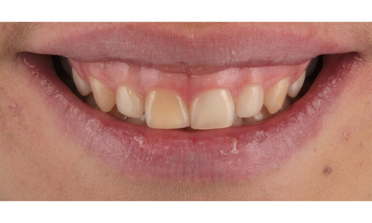 Periodoncia-Caso-Clinico-16