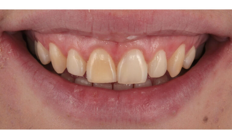 Periodoncia-Caso-Clinico-17