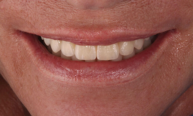 Rehabilitacion-Caso-Clinico-10