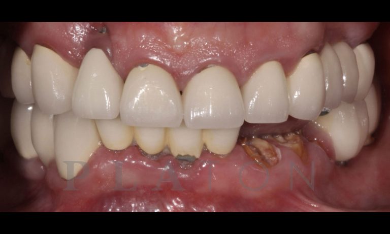 Rehabilitacion-Caso-Clinico-11