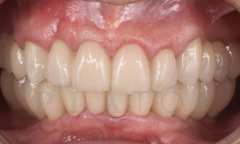 Rehabilitacion-Caso-Clinico-12