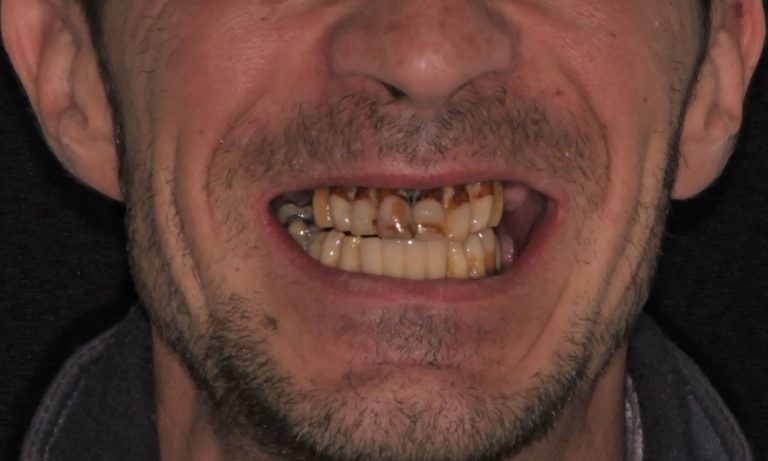 Rehabilitacion-Caso-Clinico-13