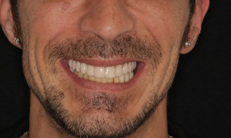 Rehabilitacion-Caso-Clinico-14