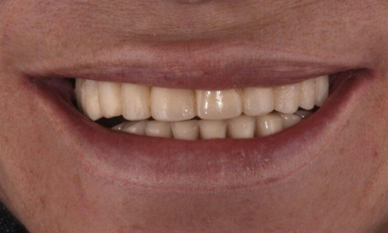 Rehabilitacion-Caso-Clinico-9