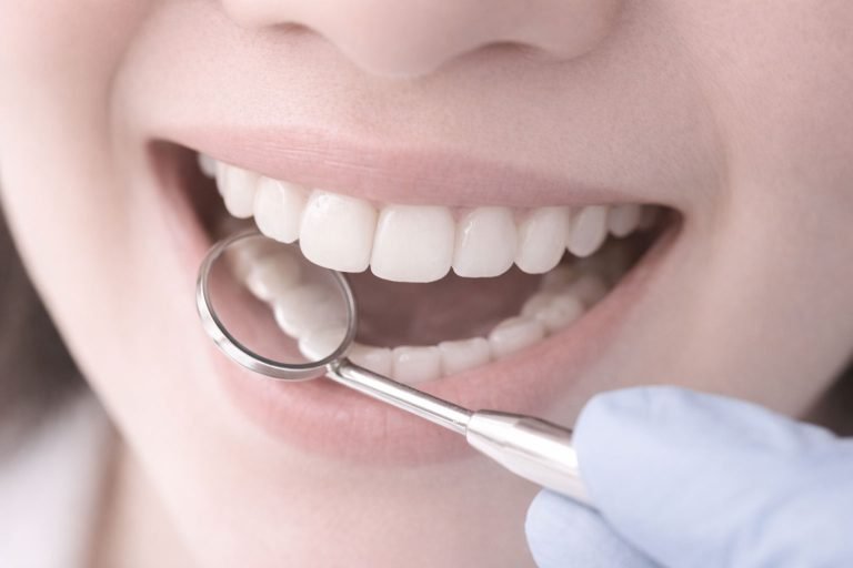 Inspección de sarro dental en una paciente