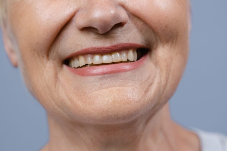 Dientes dañados por el tabaco mostrando decoloración y deterioro de la higiene dental.